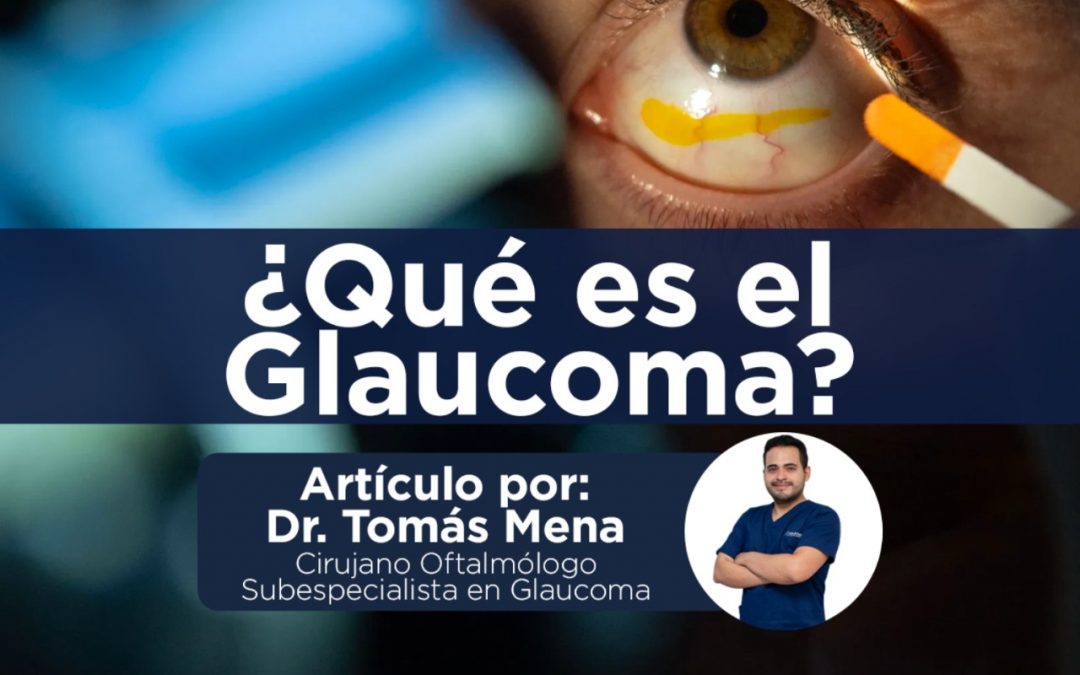 ¿Qué es el glaucoma?